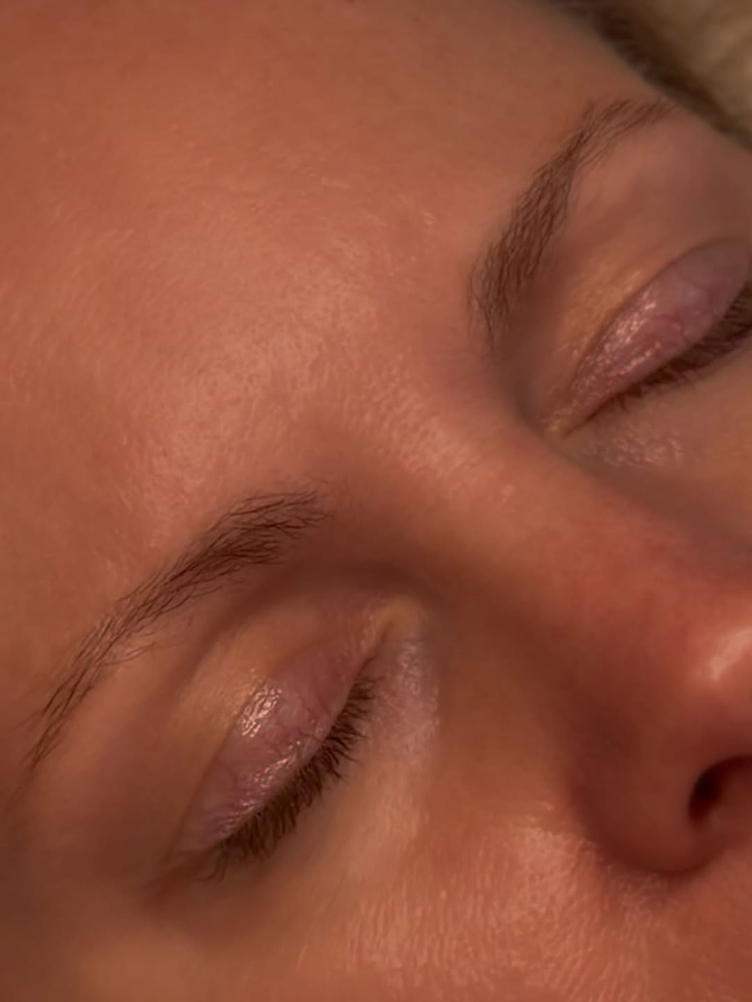 Client eye close up after treatment